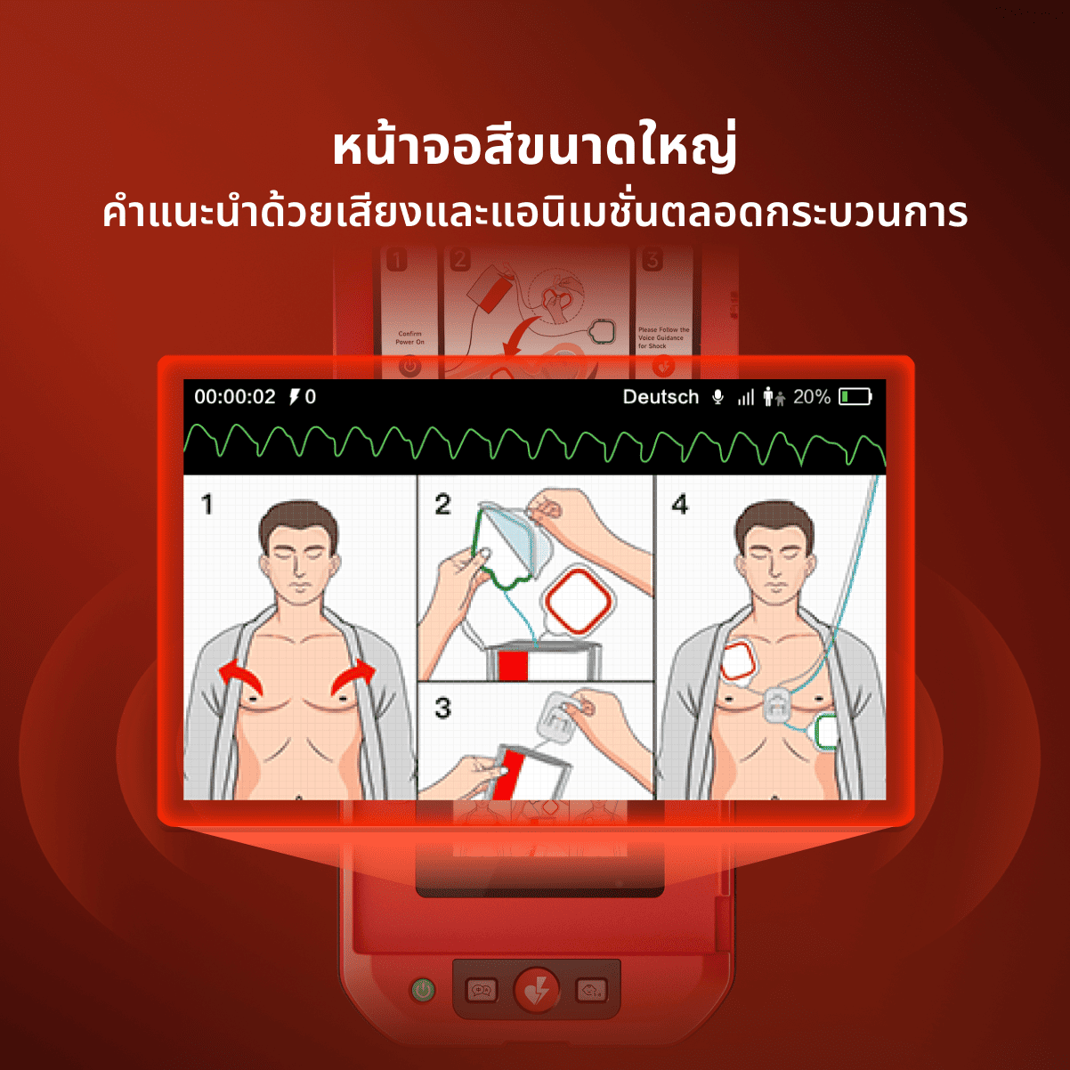 เครื่องกระตุกหัวใจไฟฟ้าอัตโนมัติ HeartSave Y