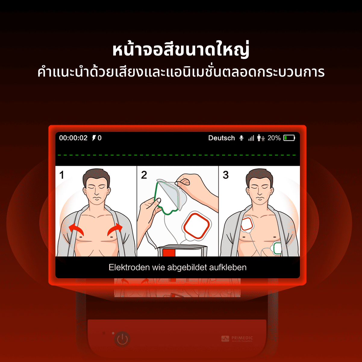 เครื่องกระตุกหัวใจไฟฟ้าอัตโนมัติ HeartSave myPAD-675A