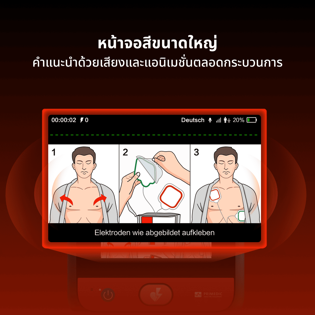 เครื่องกระตุกหัวใจไฟฟ้าอัตโนมัติ HeartSave myPAD-675 AED